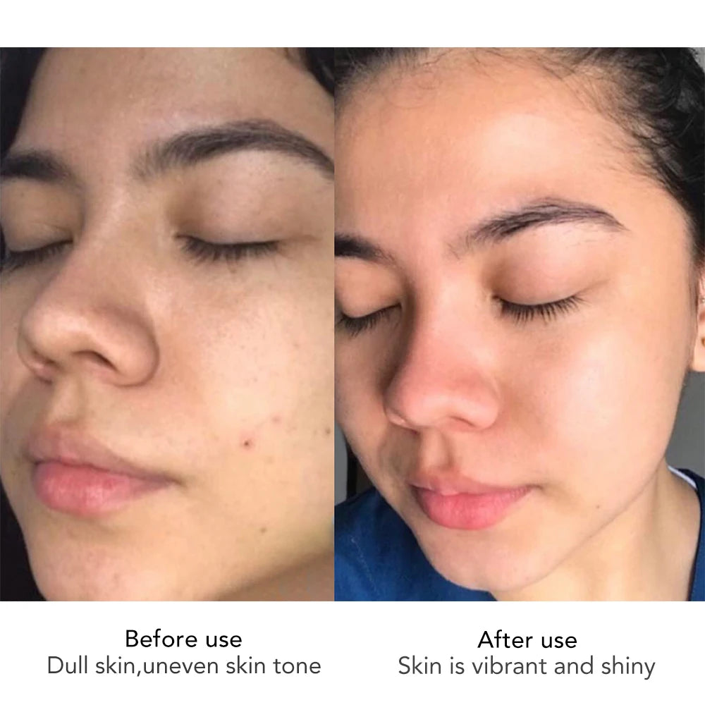 AILKE Lightening Face Cream With Hyaluronic Acid for Radiant Skin