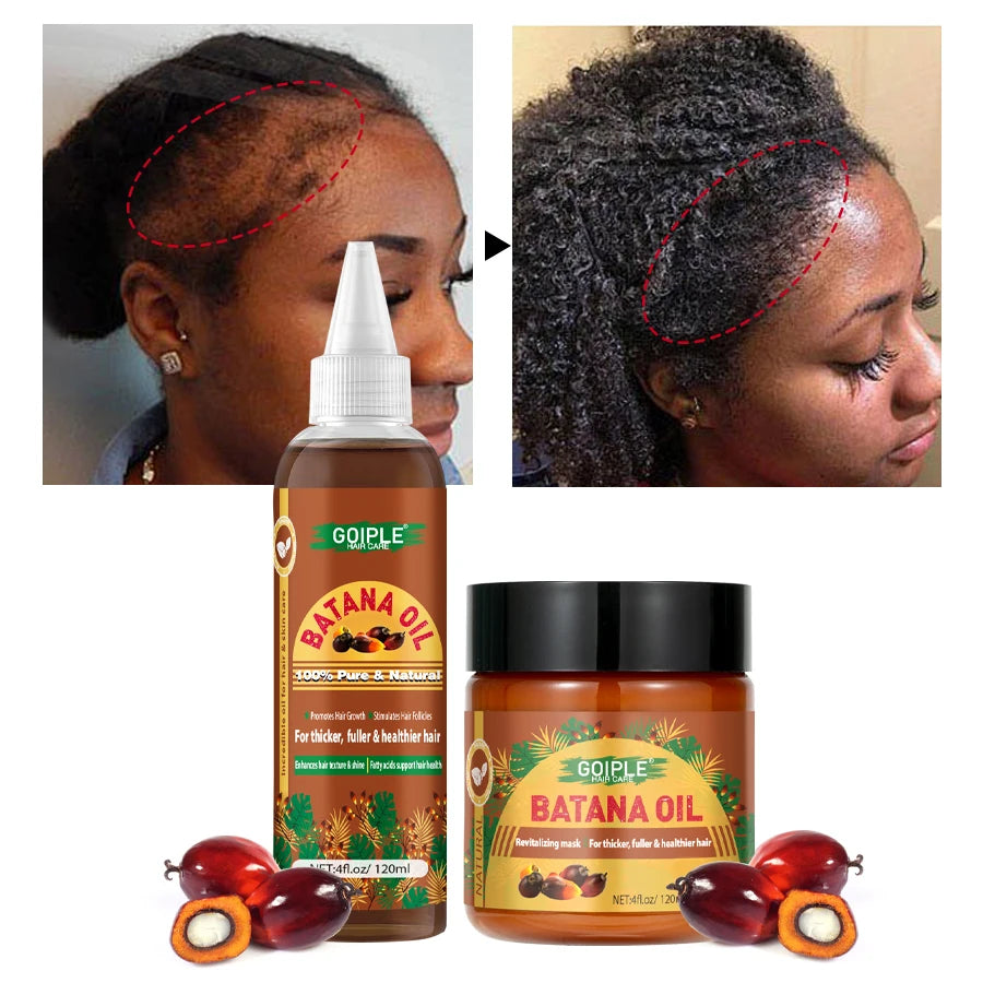 Goiple Batana Oil Hair Growth Serum for Damaged Scalp Nourishment