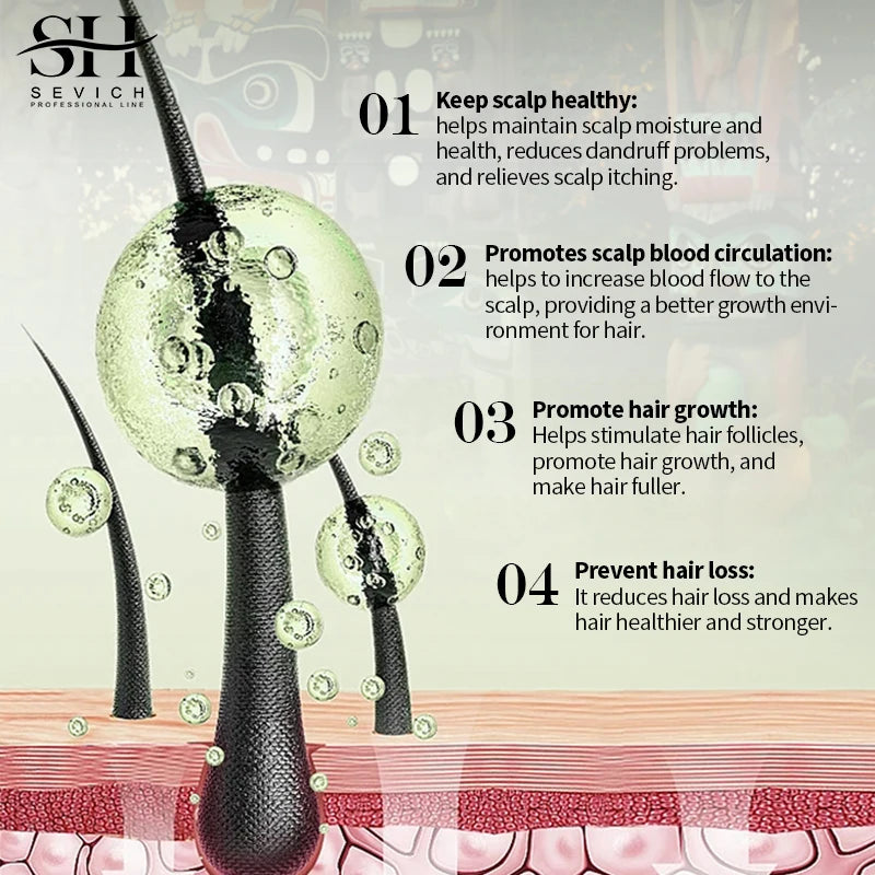 Sevich Ayurvedic Hair Growth Oil Anti Hair Loss Regrowth