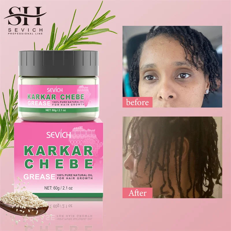 Sevi Karkar Butter Hair Growth Oil for All Hair Types