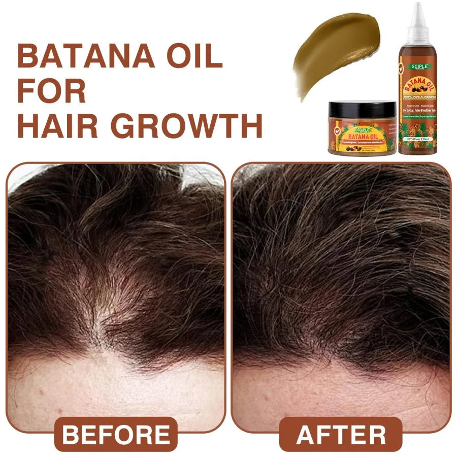 Goiple Batana Oil Hair Growth Serum For Nourished Scalp And Thicker Hair