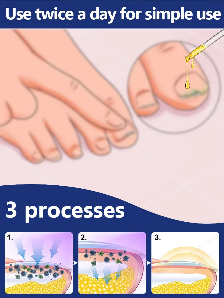 Electric Tea Tree Fungus Care Tool 10ml Foot Nail Care