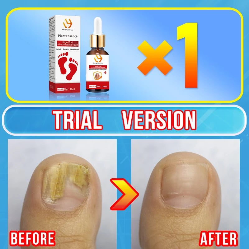 Electric Tea Tree Fungus Care Tool 10ml Foot Nail Care