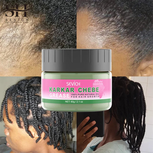 Sevi Karkar Butter Hair Growth Oil for All Hair Types