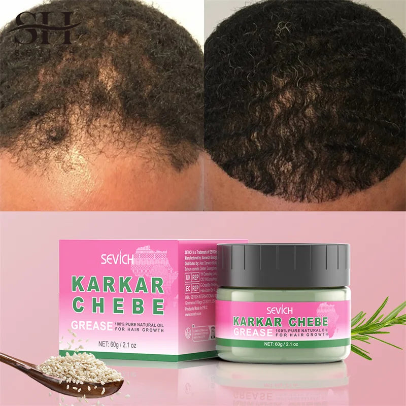 Sevi Karkar Butter Hair Growth Oil for All Hair Types