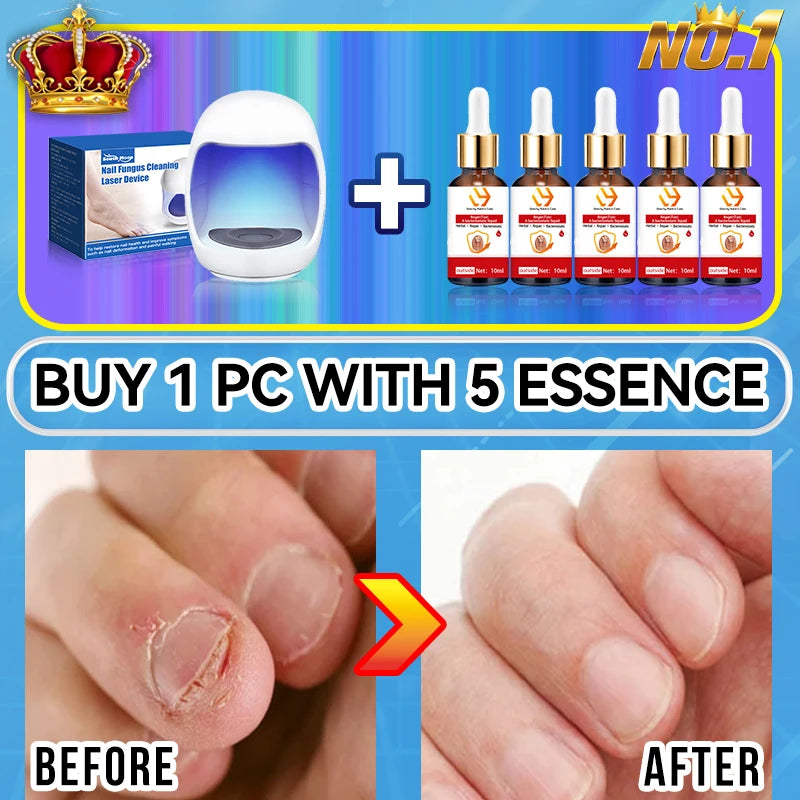 Electric Tea Tree Fungus Care Tool 10ml Foot Nail Care