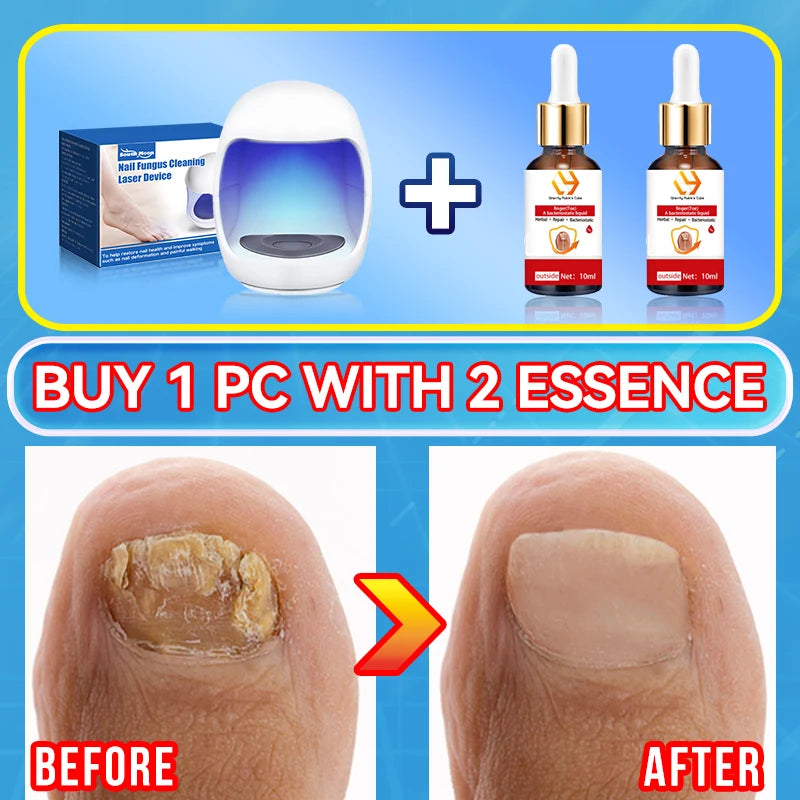 Electric Tea Tree Fungus Care Tool 10ml Foot Nail Care