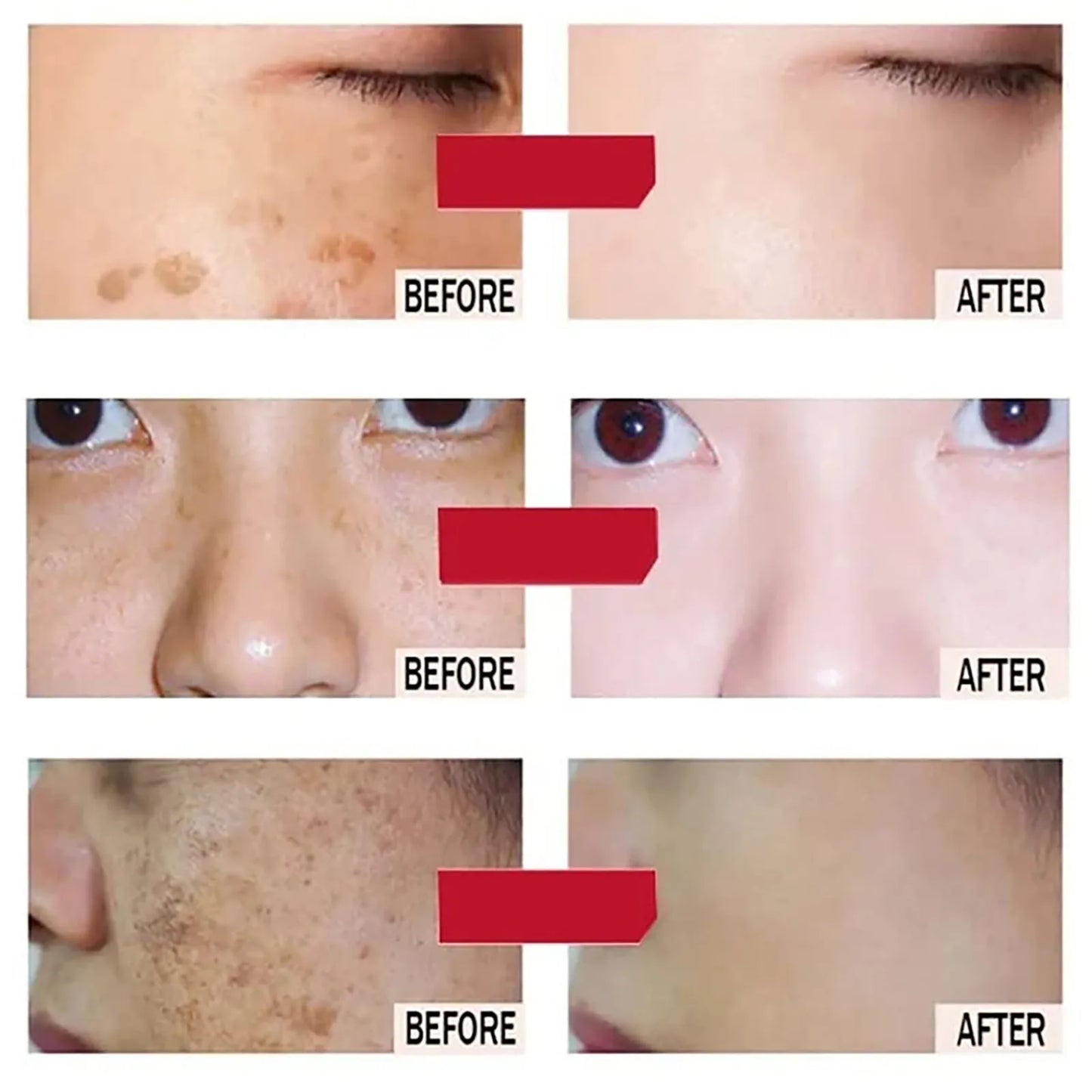 AILKE Lightening Facial Cream Spot Reduction All Skin Types