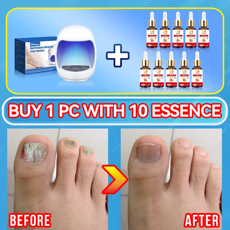 Electric Tea Tree Fungus Care Tool 10ml Foot Nail Care